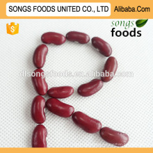 Type of Chinese 2015 New Crop Dry Red Pinto Bean